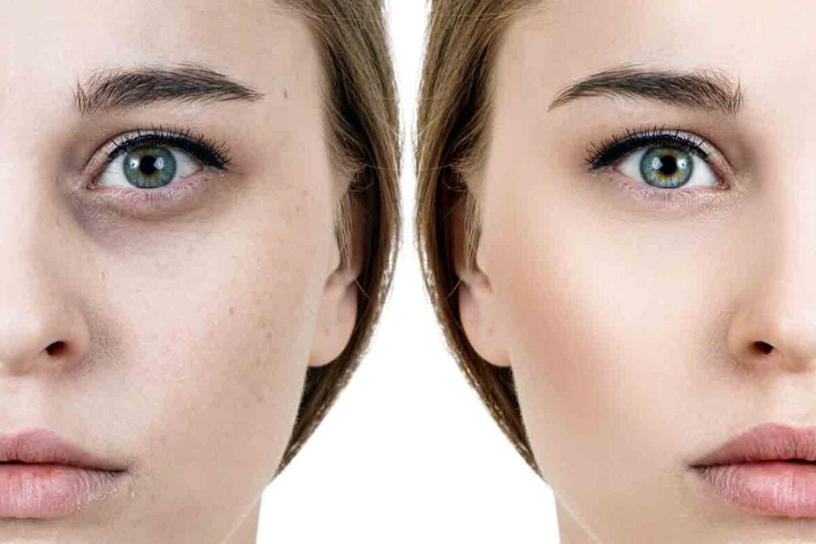 Pod očmi brez podočnjakov: Nov izdelek za takojšen učinek in večjo elastičnost kože