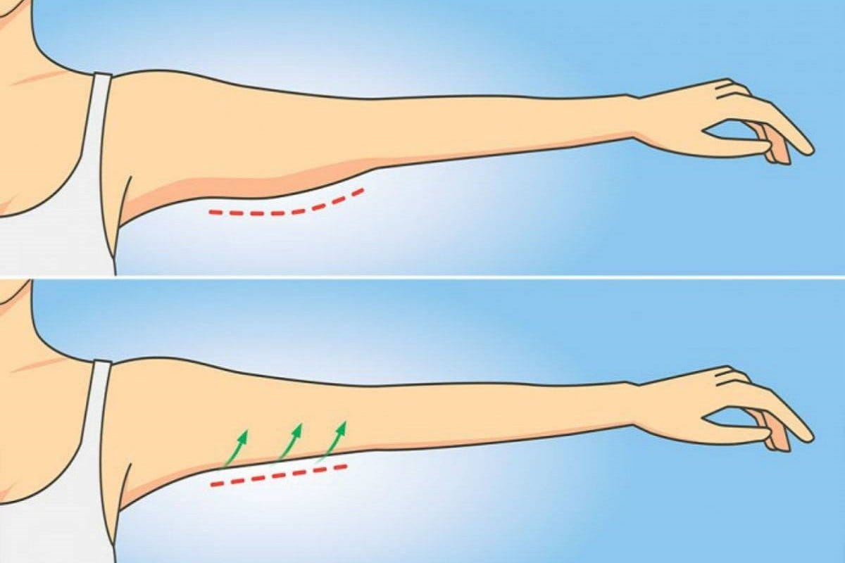 Kako shujšati v rokah: prehrana, vaje za doma in telovadnico ter nasveti trenerja