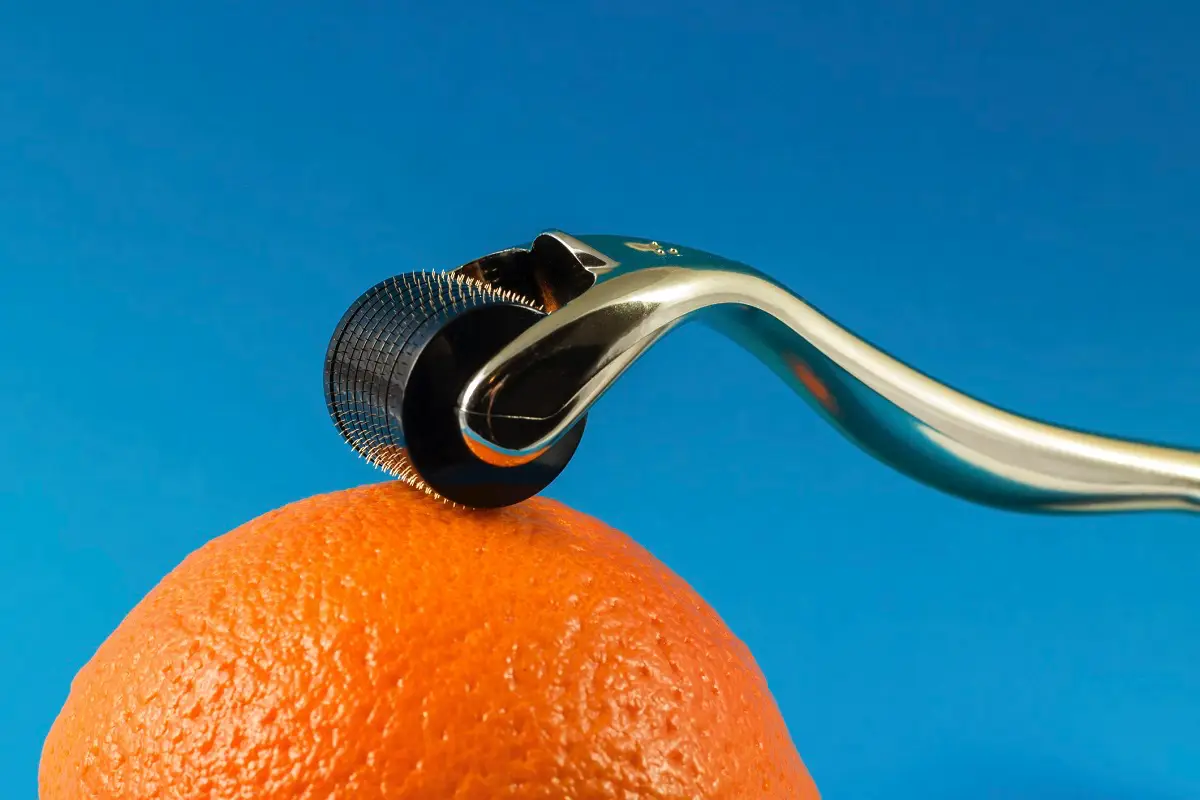 8 vprašanj in odgovorov o celulitu