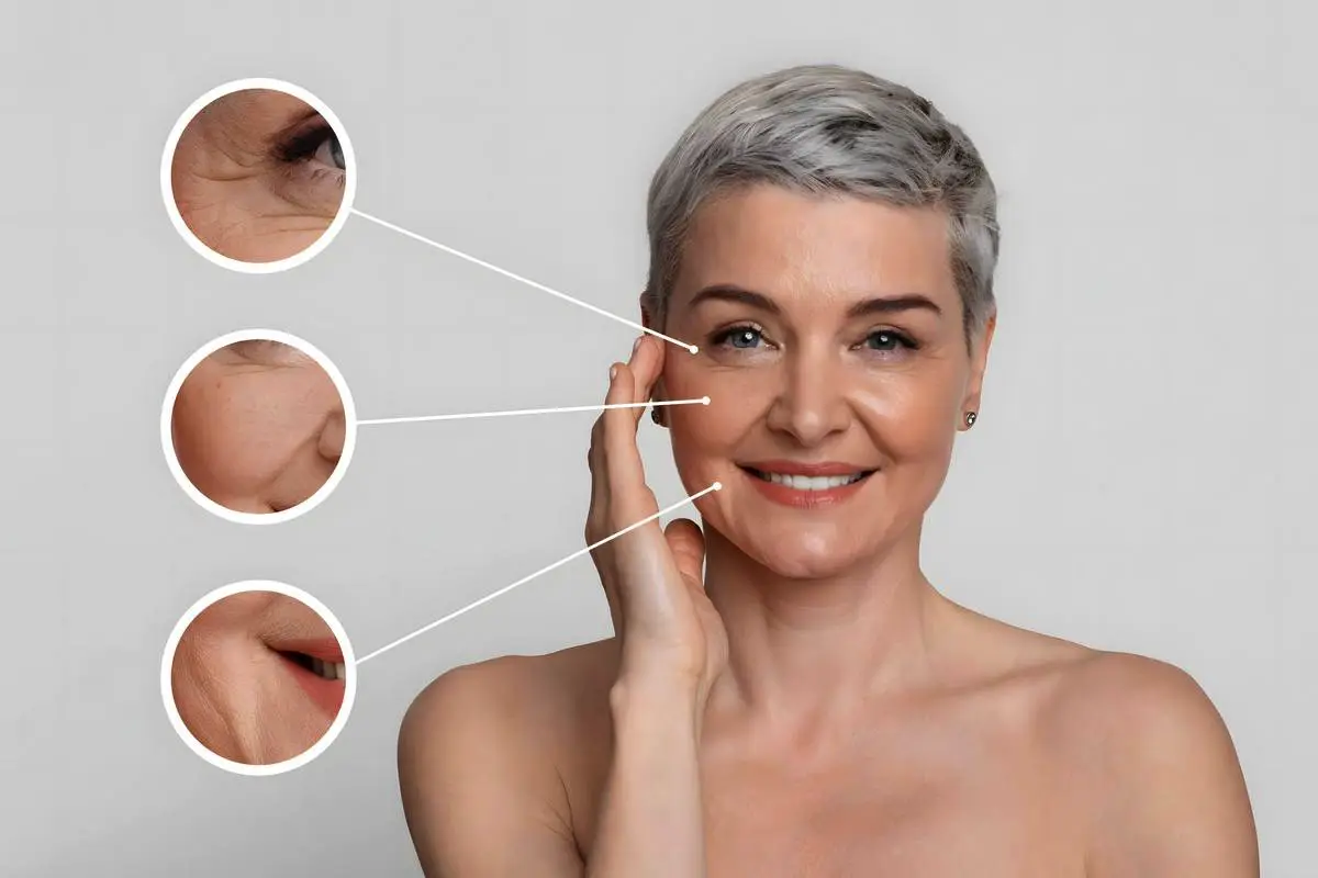 Ne le starost: Zakaj nastanejo gube in kako jih učinkovito zmanjšati