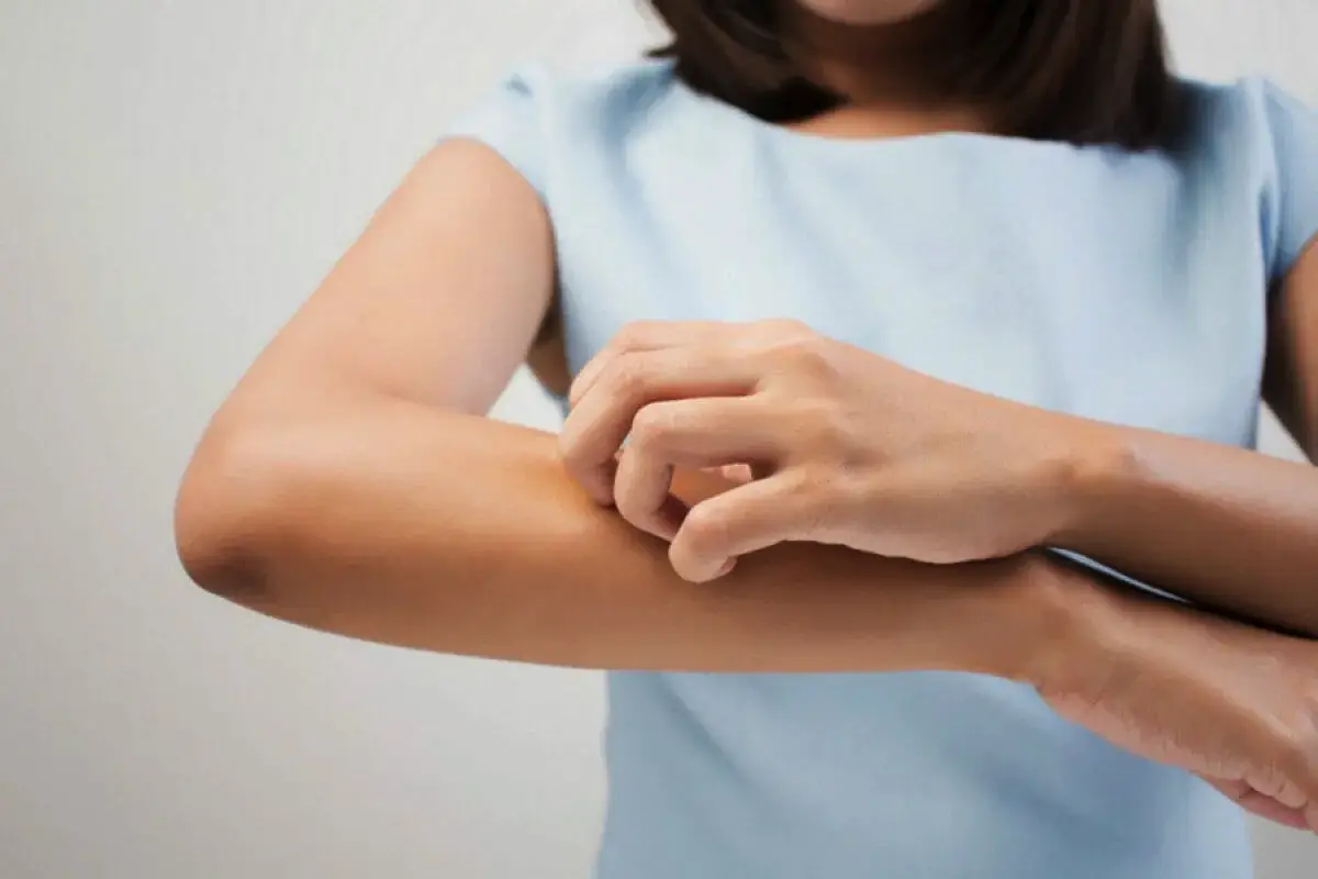 Ne dotikaj se tega! Kaj je kontaktni dermatitis