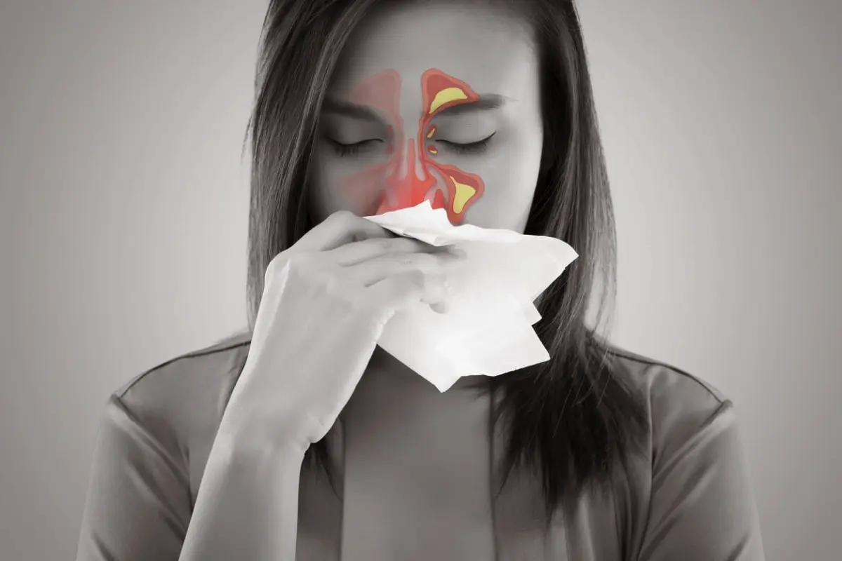 Ne le suh zrak: Kako ustaviti krvavitev iz nosu in kdaj obiskati zdravnika