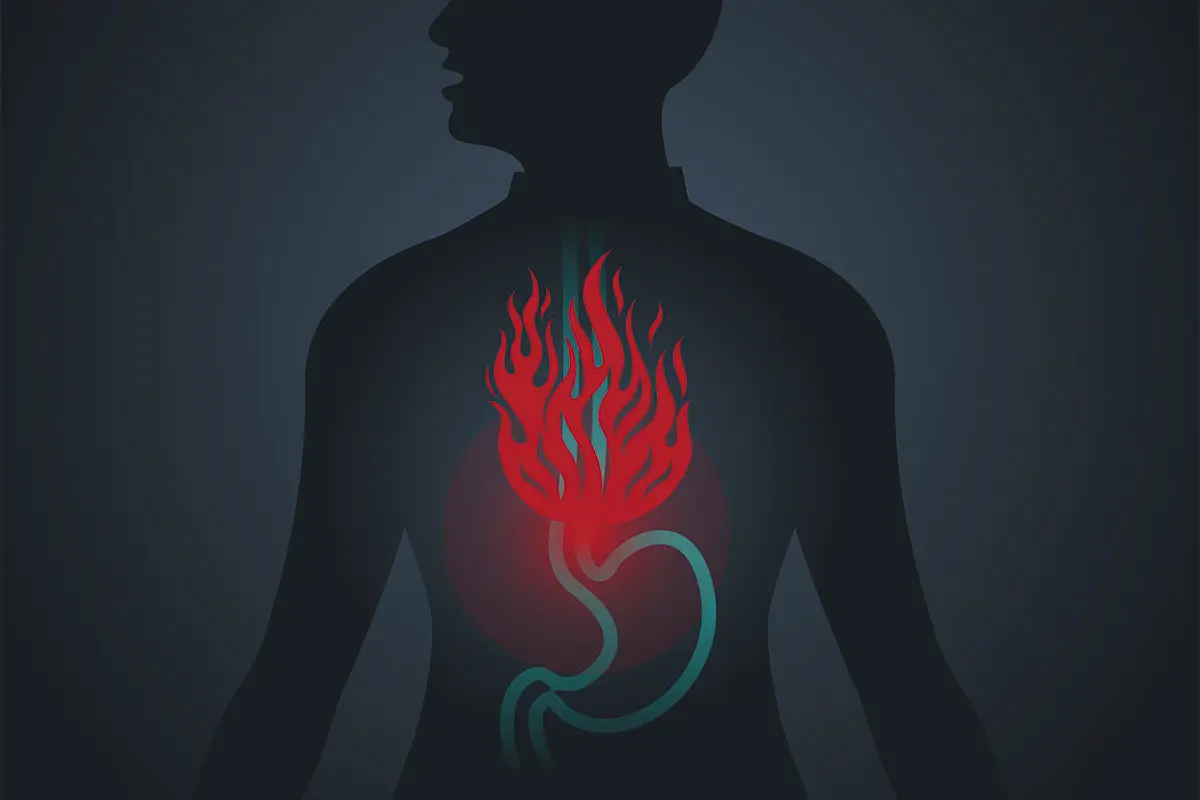 Zakaj nastane zgaga in kako jo preprečiti