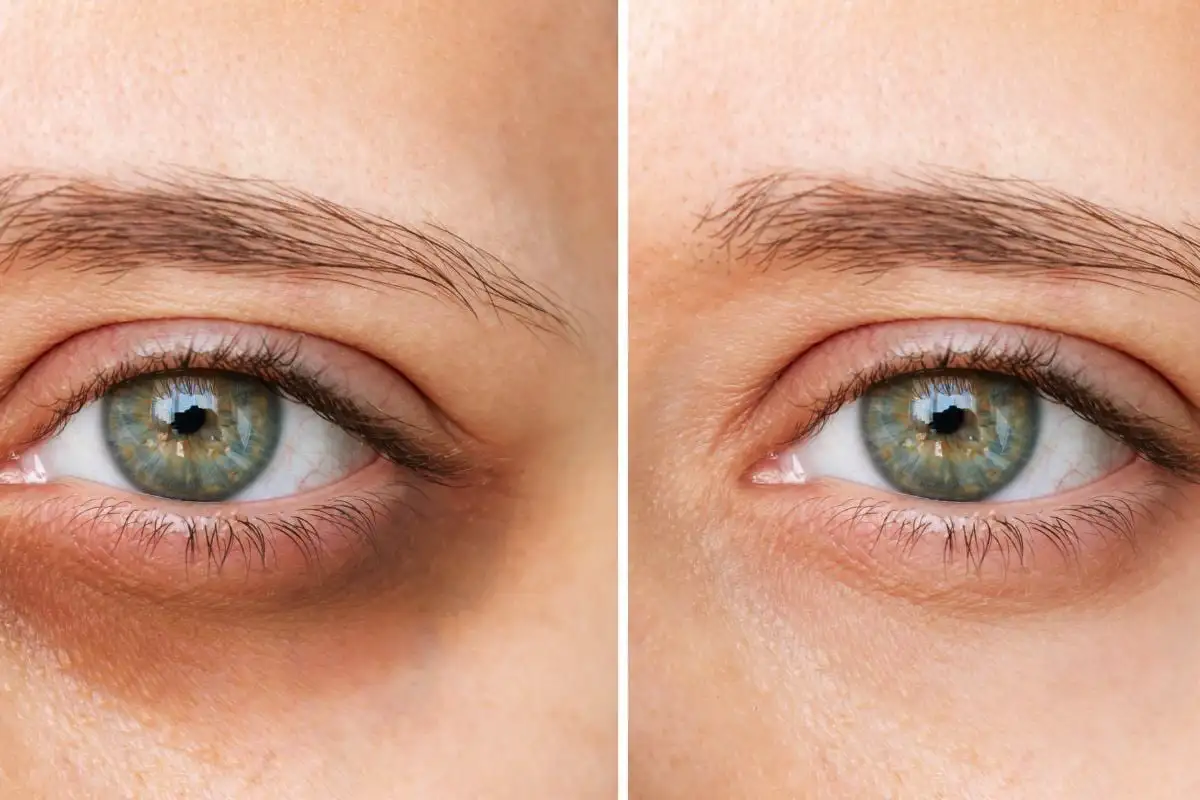 Kako bodo ljudje izgledali čez 25 let: Ali obstaja možnost, da se izognemo tej žalostni usodi?