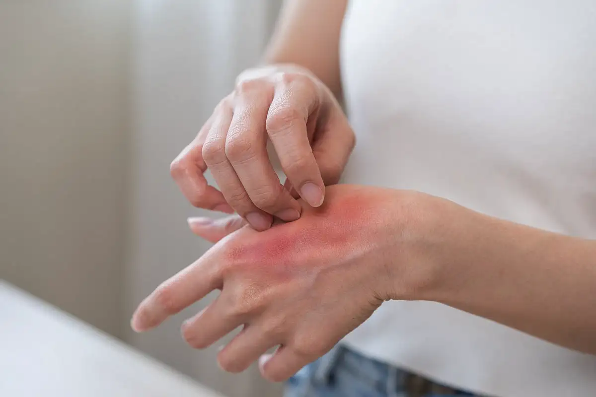 Čustvena alergija: Ko telo s fizičnimi simptomi reagira na čustvene situacije