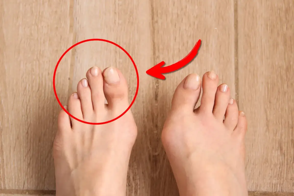 Ko je drugi prst na nogi daljši od palca, to ni napaka – to je starodavni znak, ki ga imajo le izbranci 