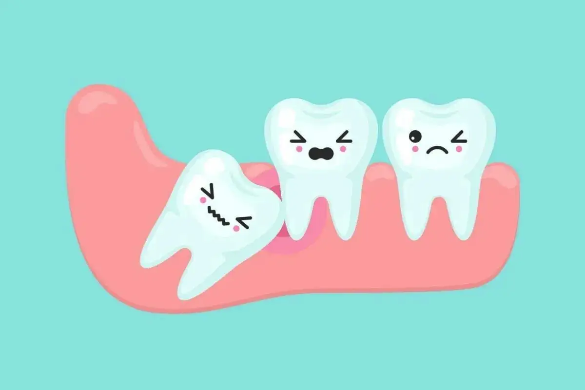 Modrostni zobje: razkrivamo 3 najpogostejše mite o njihovem odstranjevanju – kdaj je res potrebno in kako brez bolečin